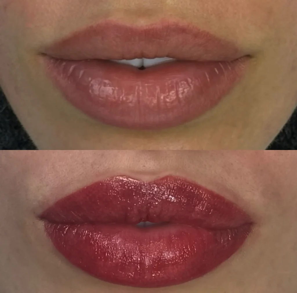 cosmetic procedures
