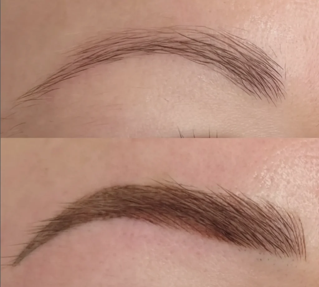 Cosmetic tattooing