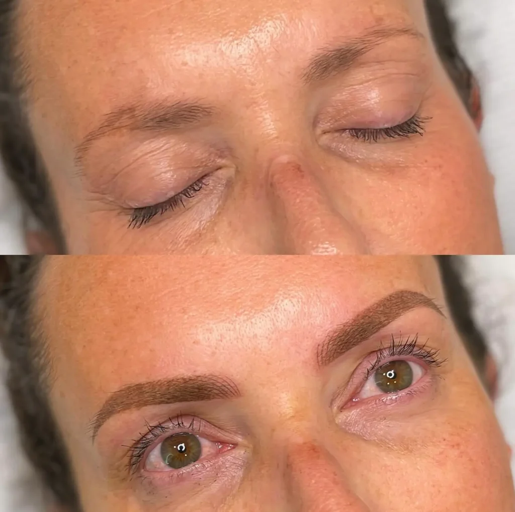 cosmetic tattooing Melbourne