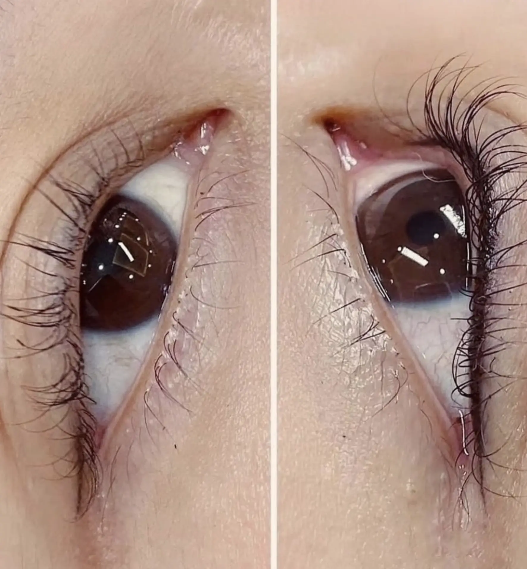 cosmetic eyeliner tattooing